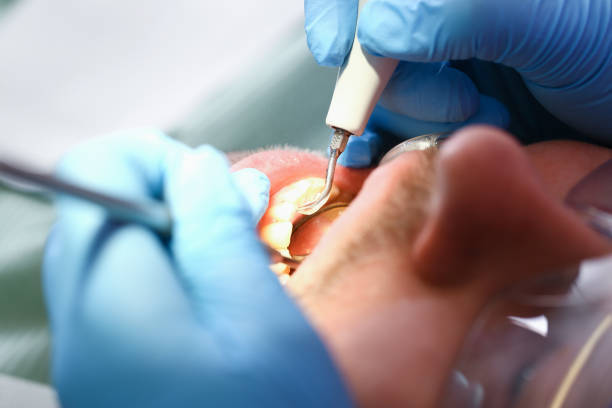 Best Tooth Infection Emergency Dentist  in West Baraboo, WI